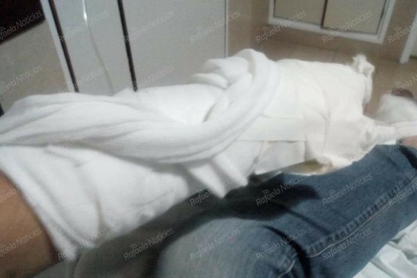 Joven gravemente herido en ocasión de robo