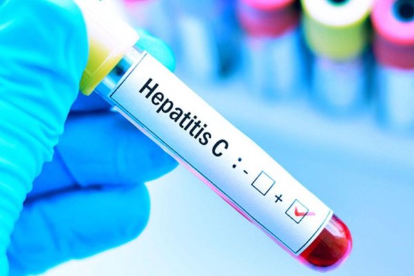 Lanzan una campaña que busca pacientes con hepatitis C para curarlos