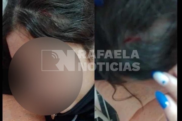 Violencia en una escuela: agredieron a una alumna con una manopla y le provocaron un corte en la cabeza